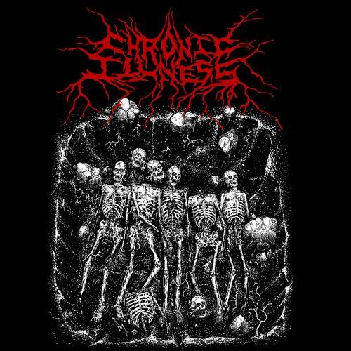 Chronic Illness - Mass Grave [EP] (2024)